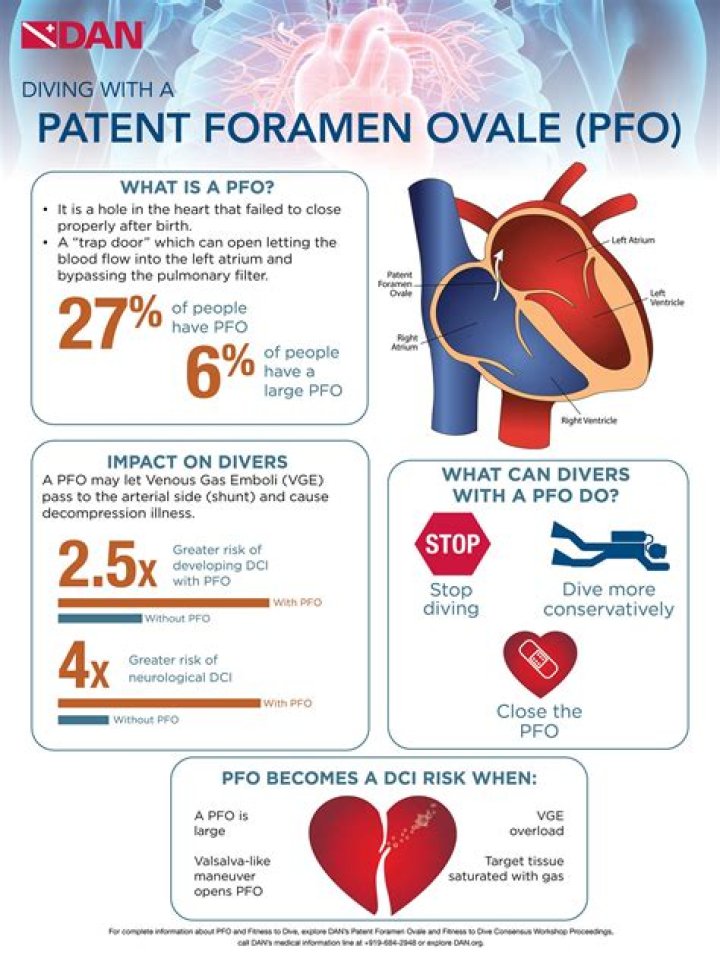 What happens when foramen ovale does not close?