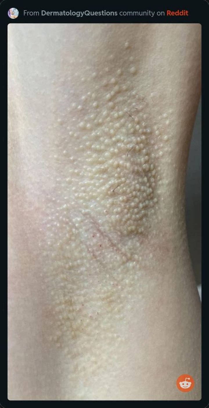 What happens when you put an onion under your armpit?