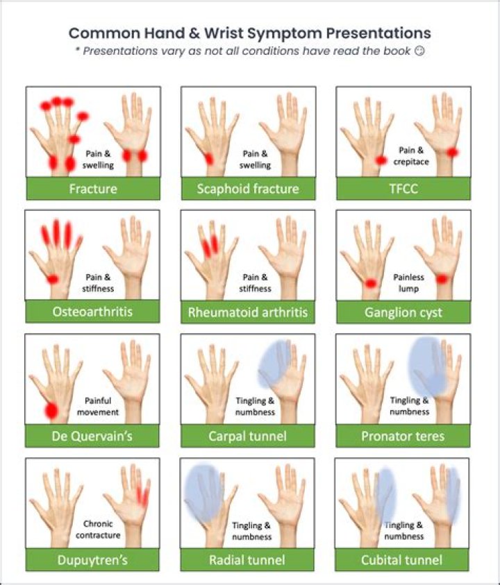 What helps hand and finger pain?