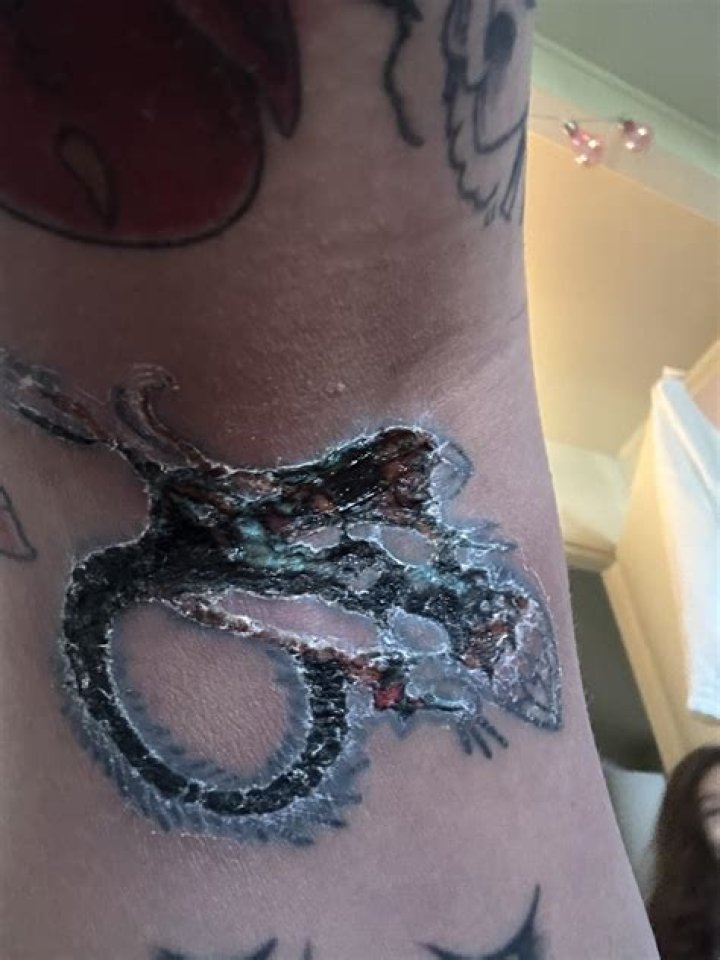 What is a ditch tattoo?