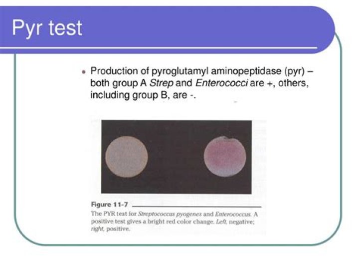 What is a PYR test?