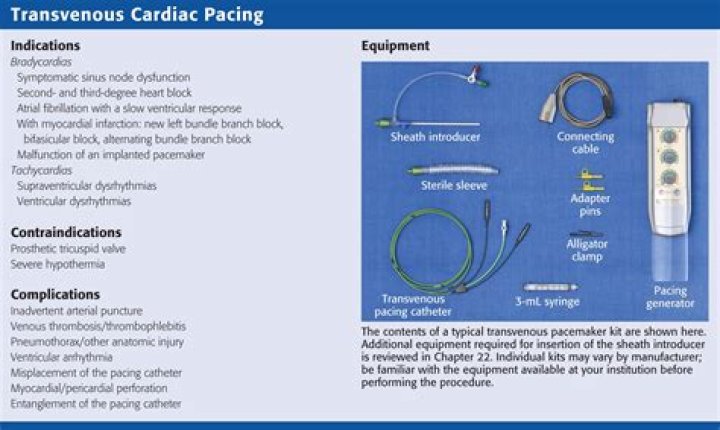 What is a temporary transvenous pacemaker?