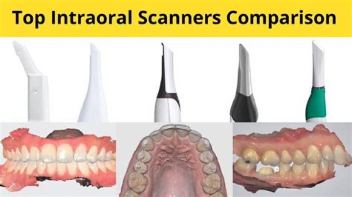 What is an intraoral complete series?