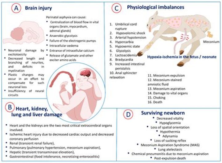 What is asphyxia Neonatorum?