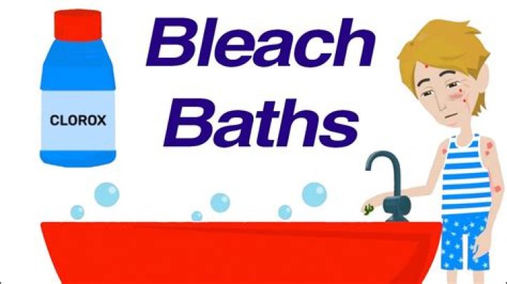 What is bleach baths good for?