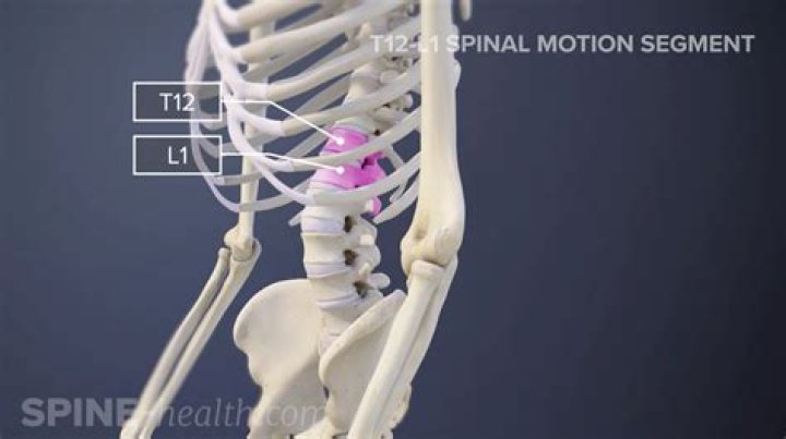 What is compression fracture t12?