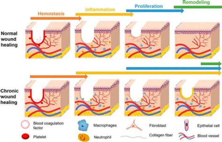 What is epithelialization of a wound?