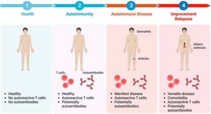 What is immune mediated diabetes?