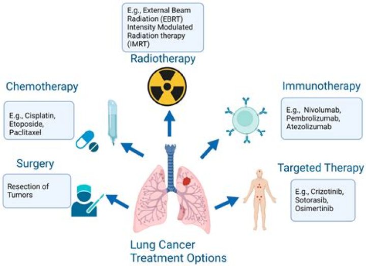 What is linac radiotherapy? | ContextResponse.com
