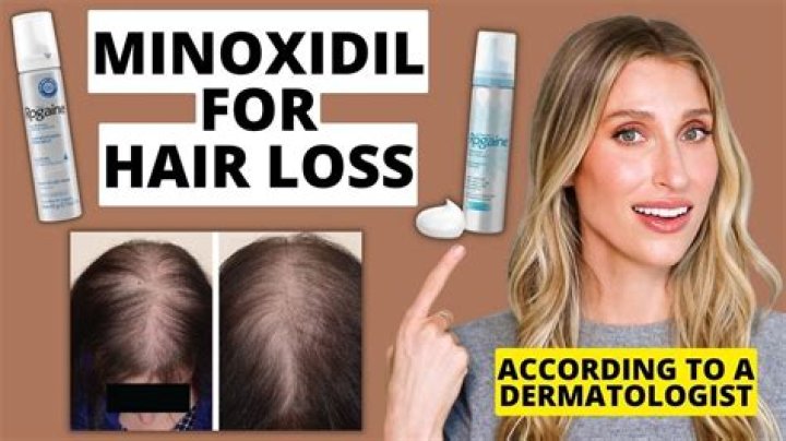 What is minoxidil used for?