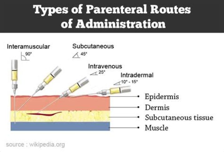 What is parenteral route of drug administration?