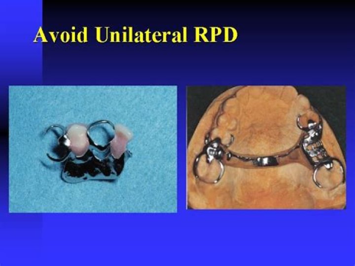 What is RPD stand for?
