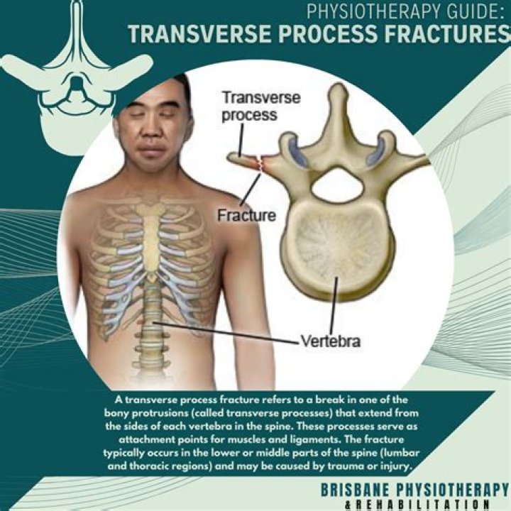 What is the difference between spinous and transverse process?