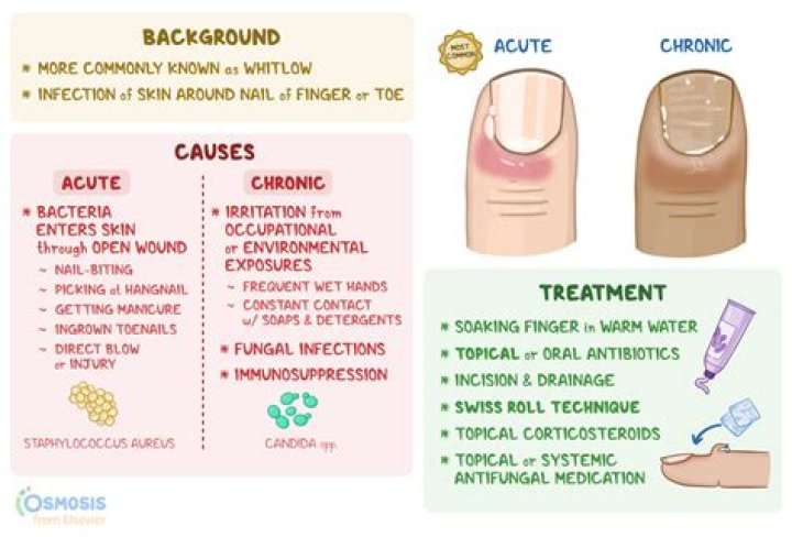 What is the main function of cuticle in plants?