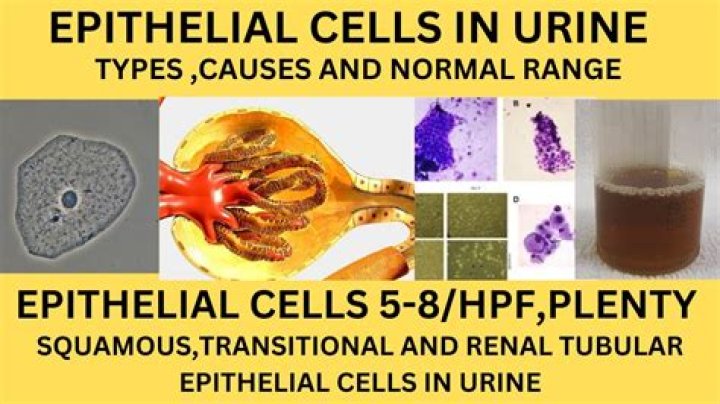 What is the normal range of pus cells in urine in HPF?