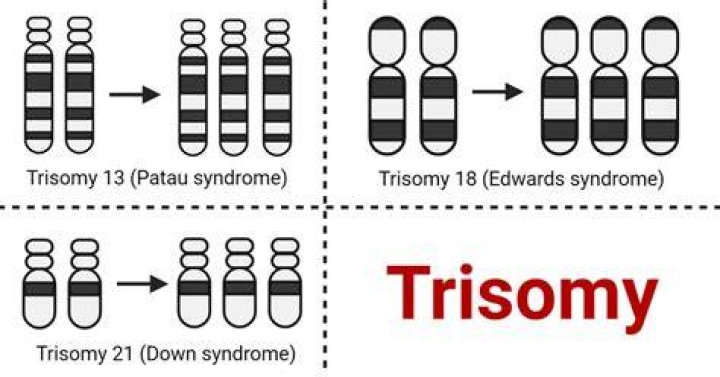 What is trisomy 8 syndrome?