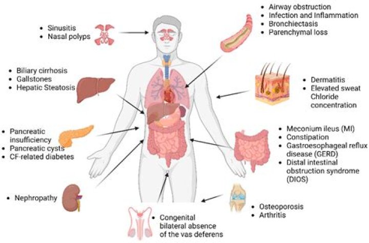 What organ is affected by nausea?