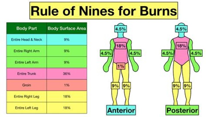 What percentage of burns is involved using the rule of nines if both front legs are burned?