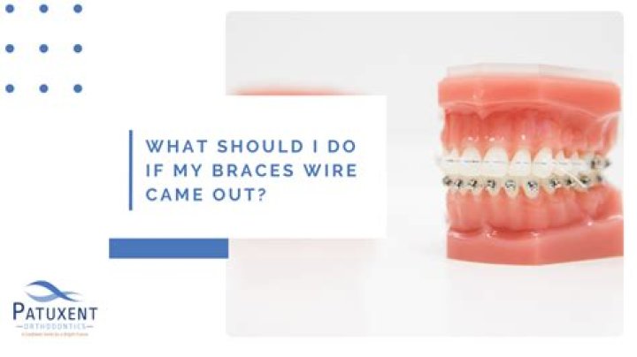 What should I do if my braces wire comes out?