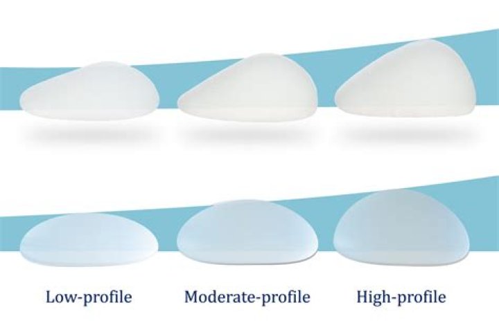 What size of breast implants should I get?