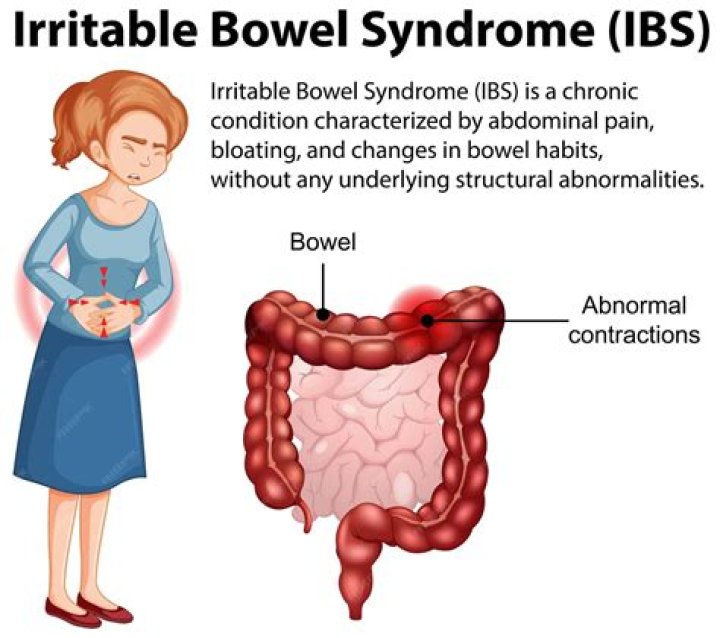 What statement describes a feature of irritable bowel syndrome?