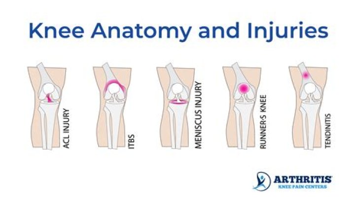 What to do if you fall and hit your knee?