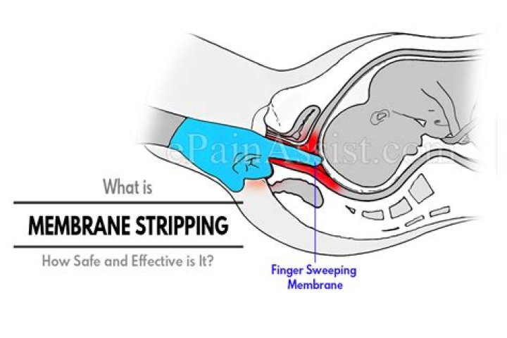 What to expect after stripping membranes?