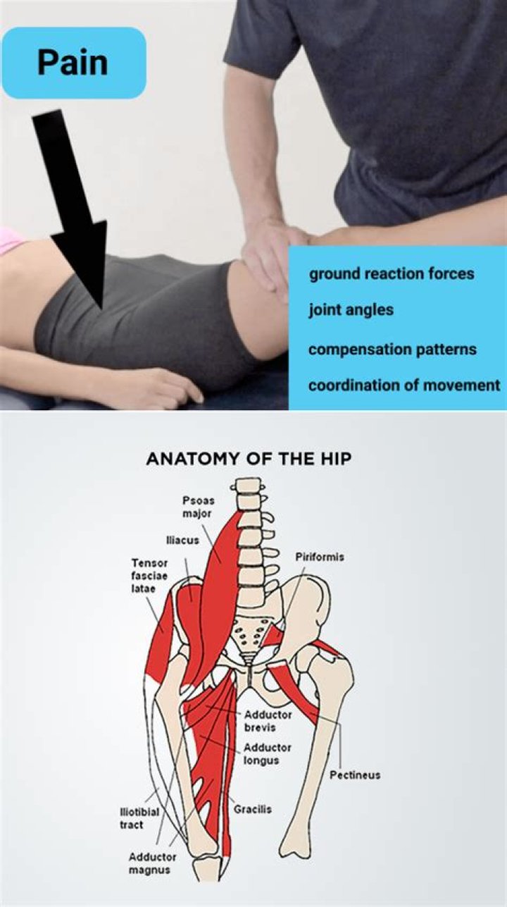 Where do u feel hip pain?