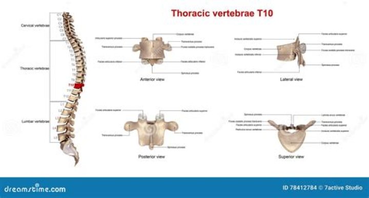 Where is the t10 vertebra?