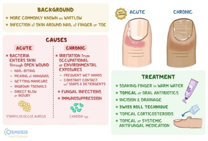 Which term refers to an infection of the fold of skin at the margin of the nail?