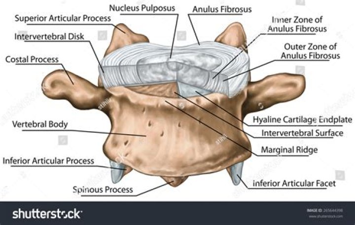 Which type of cartilage is found in the intervertebral discs?
