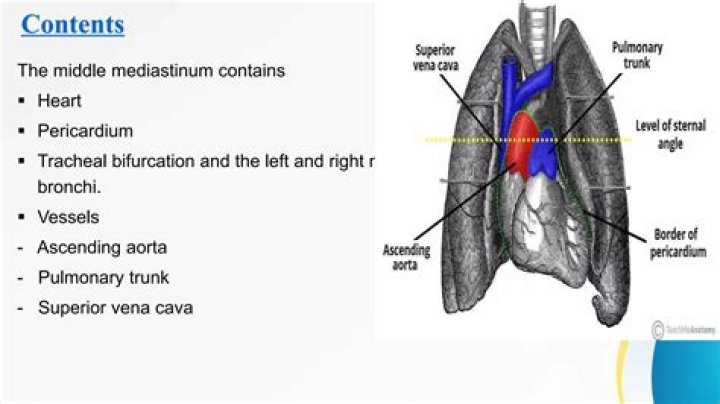 Which would be located in the mediastinum?