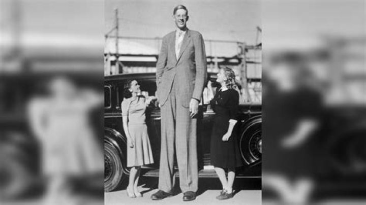 Who has the biggest human head in the world?