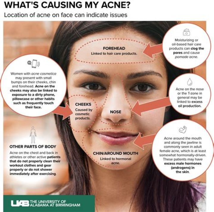Why am I breaking out around my lips?