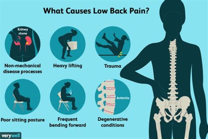 Why does my lower back hurt?