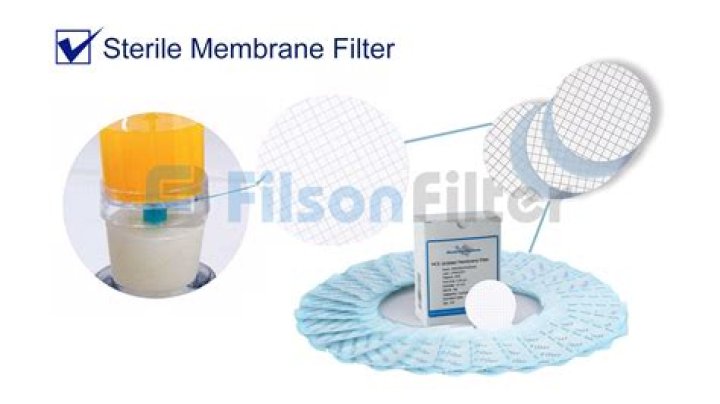 Why is tissue matching important for transplants?