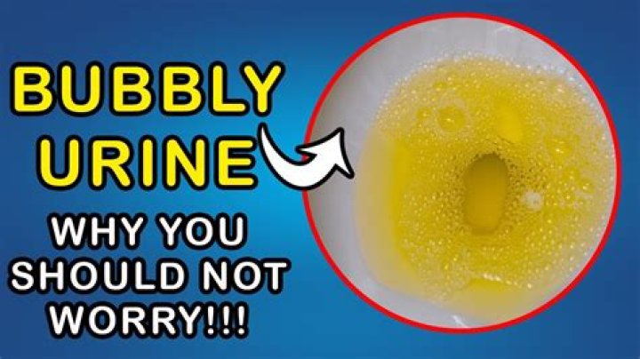 Why should air bubbles be removed from Buret tip?