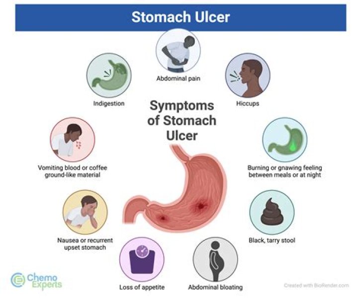 Will antacids cause constipation? | ContextResponse.com